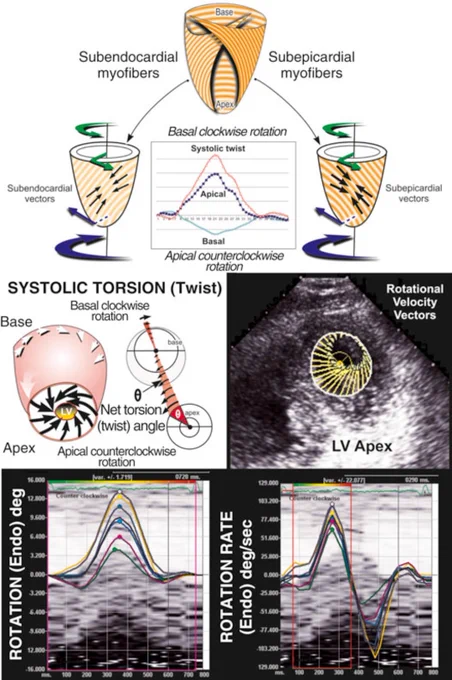 Diagram and echo images illustrating left ventricular (LV) torsion. The top half shows how subendocardial fibers cause apical counterclockwise rotation and subepicardial fibers cause basal clockwise rotation during systole. The center section explains net systolic twist (torsion) as the angle difference between apex and base. The bottom half includes echocardiographic speckle-tracking images and graphs showing LV rotation (in degrees) and rotation rate (degrees/sec) during the cardiac cycle.