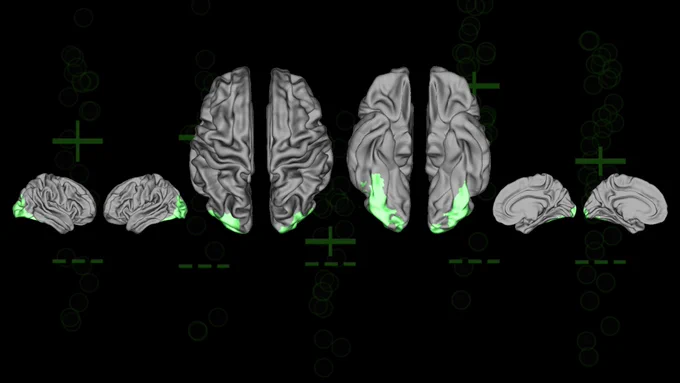 Brain scans like these helped scientists classify how study participants made decisions.
