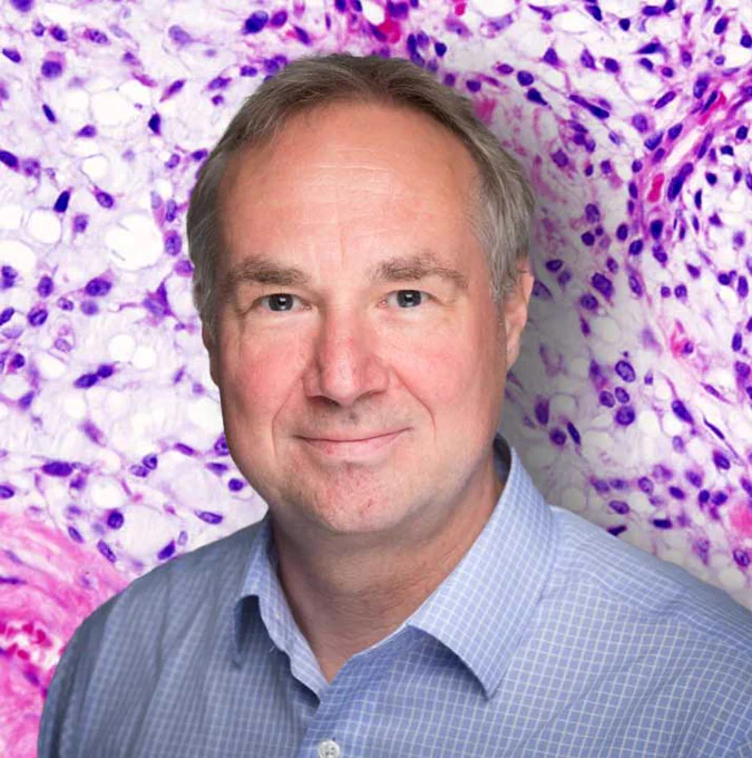 A professional headshot of Professor Udo Oppermann superimposed onto chondrosarcoma cells.