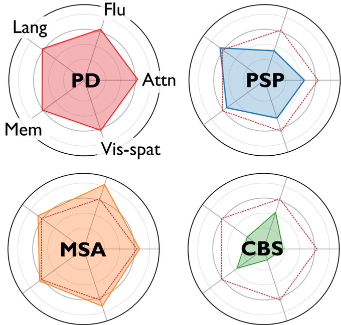 Diagnosing Parkinson’s disease is hard because of the many variants, which may have different underlying causes. Currently, arbitrary clinical criteria are used to label patitents. Harnessing two large cohorts of patients from across the UK (total N=1138), we found that patients with different labels also had different patterns on cognitive and psychiatric measures (Hu et al., Brain 2025). This helps clinicians establish diagnoses more firmly, but also use more fine-grained phenotyping that acknowledges the blurred edges between these disorders. [classifier weights also available!]. 