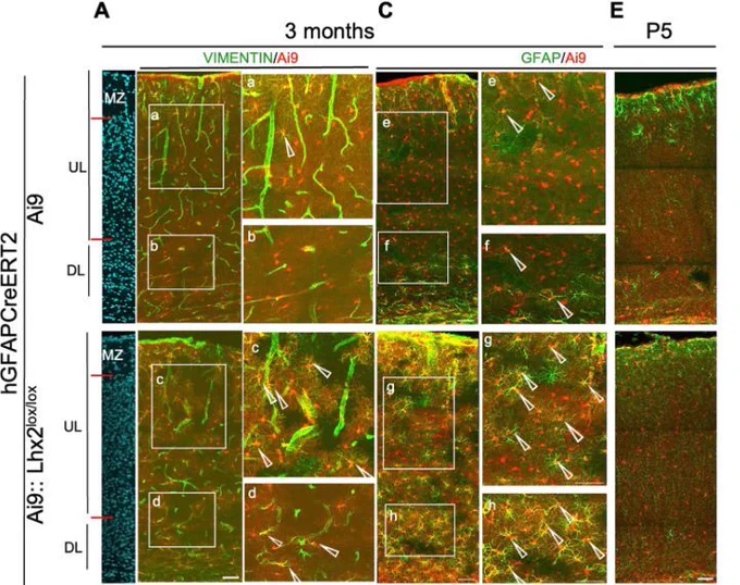 Figure 4 Long-term consequences of LHX2 loss in astrocytes. 