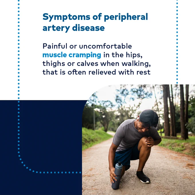 Symptoms of peripheral artery disease

Painful or uncomfortable muscle cramping in the hips, thighs or calves when walking, that is often relieved with rest
