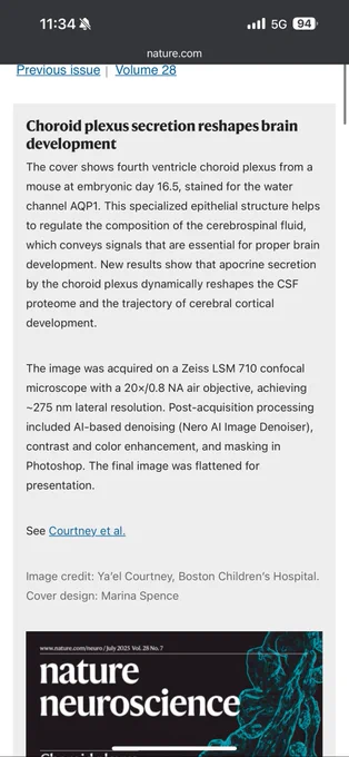 Screenshot of a webpage from nature.com describing the cover story of the July 2025 issue of Nature Neuroscience. The text explains that the cover image shows the choroid plexus of an E16.5 mouse stained for AQP1, revealing how apocrine secretion influences CSF composition and brain development. Technical details include the use of a Zeiss LSM 710 microscope with AI-based denoising and image processing. The image is credited to Ya’el Courtney, Boston Children’s Hospital, and the cover design to Marina Spence.