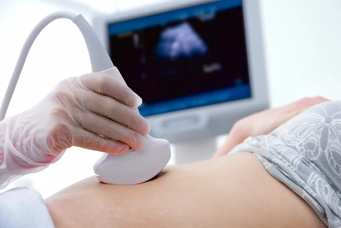 Pregnant person being scanned