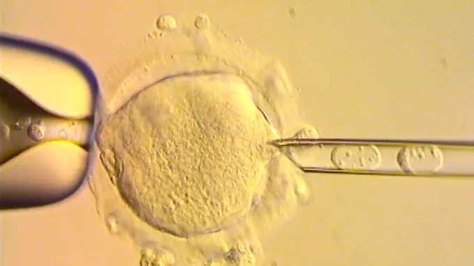 Picture of nuclear genome being placed in an egg.