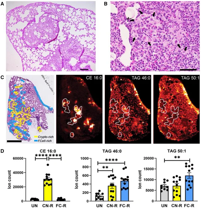 Spatial distribution of foam cells and storage lipids in C. neoformans-infected murine lungs. (A, B). H&E staining of formalin-fixed, paraffin-embedded lung sections from C. neoformans H99-infected mice. Images were photographed at (A) 100× magnification; scale bar is 100 μm; and (B) 400x magnification; scale bar is 10 μm. Black arrows indicate foam cells. 