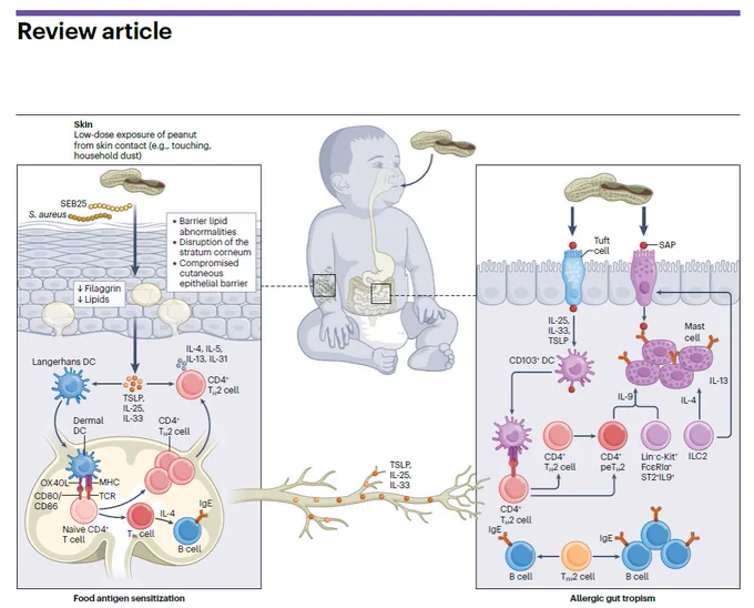https://pubmed.ncbi.nlm.nih.gov/40571771/