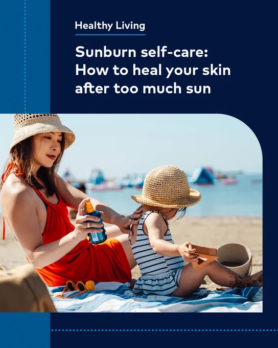 Healthy Living - Sunburn self-care: How to heal your skin after too much sun