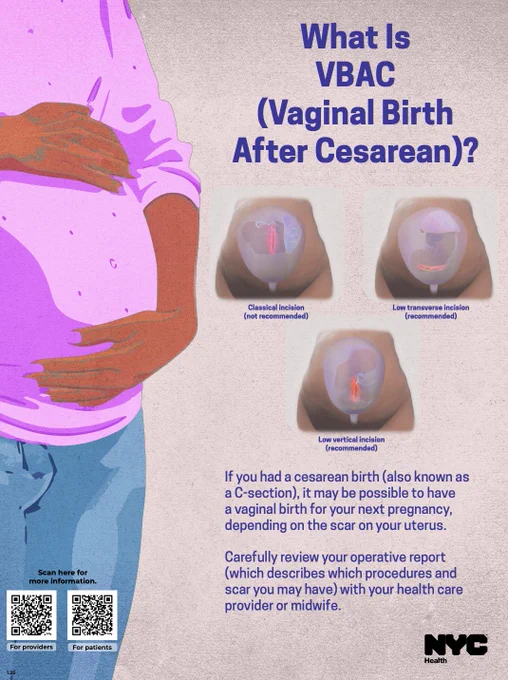 Photo of the What Is a Vaginal Birth After Cesarean? poster. Accessible PDF at the link.