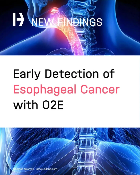 Early Detection of Esophageal Cancer with O2E