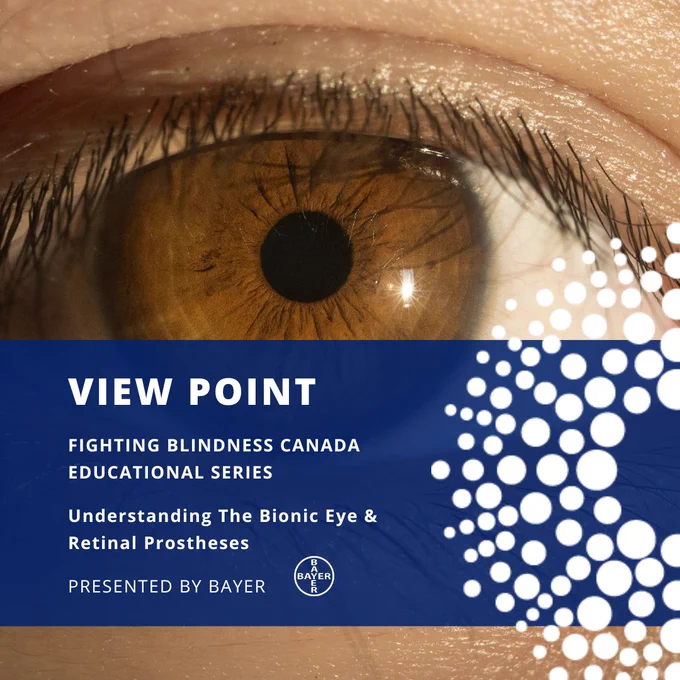 View Point
Fighting Blindness Canada Educational Series
Understanding the Bionic Eye & Retinal Prostheses
Presented by Bayer
