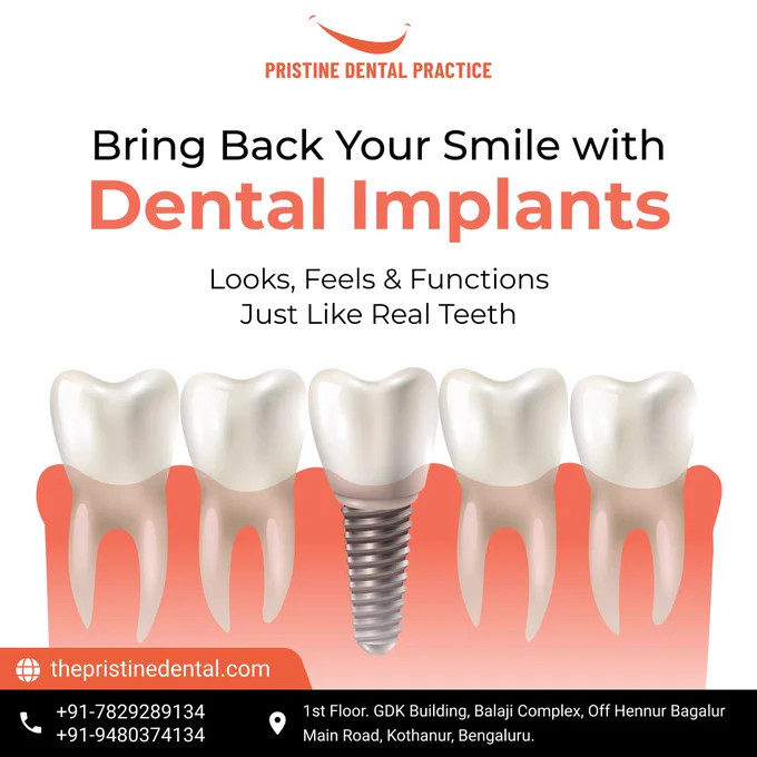 Missing teeth? Don’t let gaps hold you back! 🦷💎 Our Advanced Dental Implant Surgery in Kothanur, Bengaluru helps you bring back your smile with teeth that look, feel & function just like natural ones.

✅ Expert Consultation & 3D Scans
✅ Painless Implant Placement
✅ Natural-Looking Crowns
✅ Affordable & Long-Lasting Results

Say goodbye to missing teeth and hello to a confident new you! 😁

📍 Pristine Dental Practice
1st Floor, GDK Building, Balaji Complex, Off Hennur Bagalur Main Road, Kothanur, Bengaluru.
