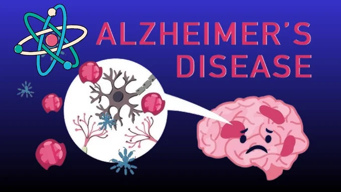 Building on recent advances in quantum machine learning (QML), which have shown impressive accuracy in classifying Alzheimer’s disease, this novel framework integrates classical and quantum computing, incorporates sophisticated quaternionic representations, and seeks to provide a more sensitive and predictive tool for identifying disease progression and therapy resistance.