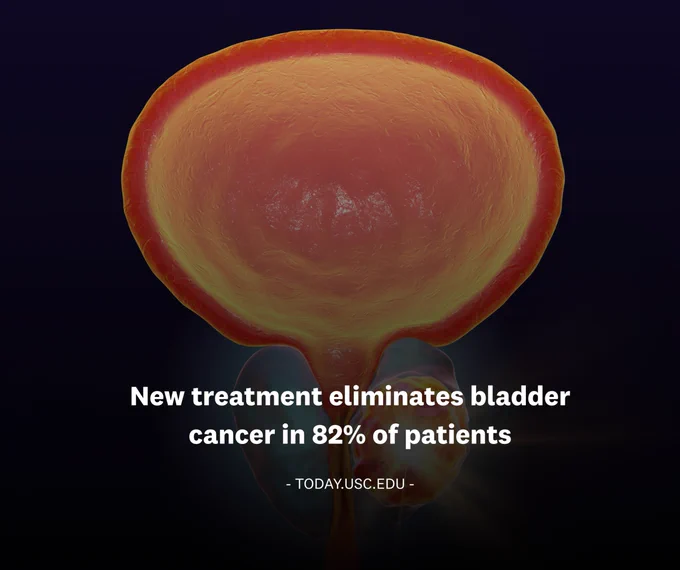 Slow drug-release system found highly effective in treating certain patients with bladder cancer whose tumors were previously unresponsive to cancer therapy.