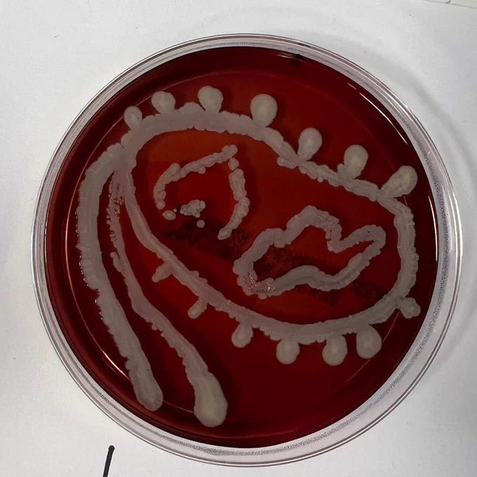 Aisha's winning agar art plate!