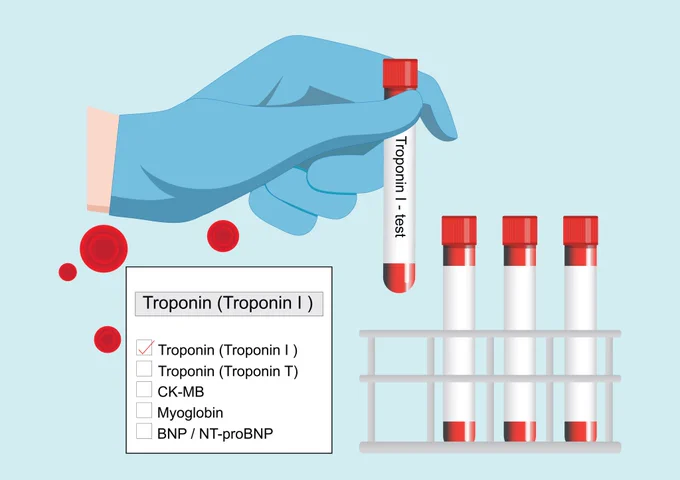 An illustration shows a gloved hand holding a blood test tube labeled "Troponin I - test." On a table next to a test tube rack with three other test tubes, a checklist is displayed with "Troponin (Troponin I)" selected. Other options on the checklist include "Troponin (Troponin T)," "CK-MB," "Myoglobin," and "BNP / NT-proBNP." Red blood cells are scattered.