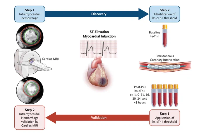A figure illustrating the two-step process for the detection and validation of hemorrhagic MI using hs-cTn-I thresholds and CMR.