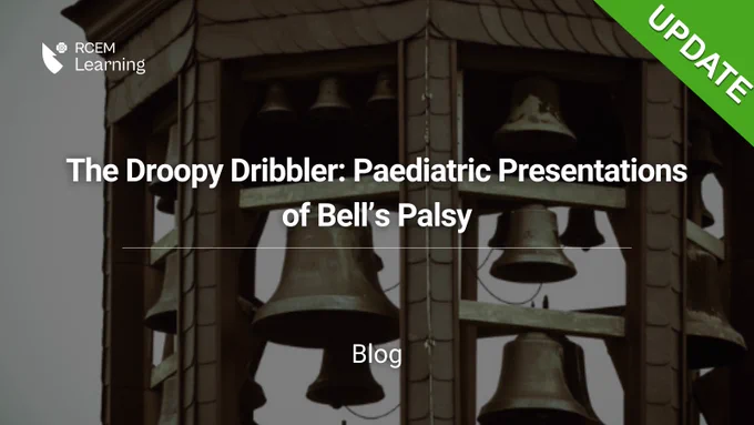 The Droopy Dribbler: Paediatric Presentations of Bell’s Palsy. UPDATE. Blog