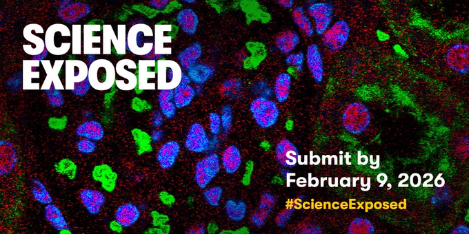 IMAGE: In the background, we see one of the finalist images of our "Science Exposed 2025" contest, a fluorescence microscopy image of kidney cells showing the effects of ischemia, a condition in which oxygen supply to the kidney is reduced, impairing organ function. On top of the image we see, in white, the title of the context and “Submit by February 9, 2026” as well as the hashtag #Science Exposed in yellow. Background image by Elizabeth Anim from McGill University.”. (Background image by Elizabeth Anim from McGill University.)