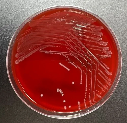 Fig. 1: Appearance of L. garvieae isolate on horse blood agar after 24 h incubation at 37 °C in 5% CO2.