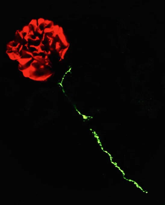 Kidney microscopy image that looks just like a rose. The glomerulus is red and looks like a ball of petals and a green axon looks like a long stem.