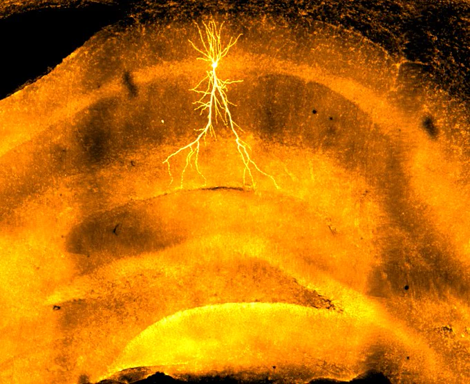 Targeted neuron in murine hippocampus.