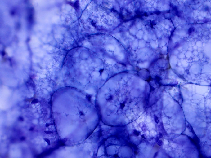 Cells show vacuolated cytoplasm and central uniform nuclei
