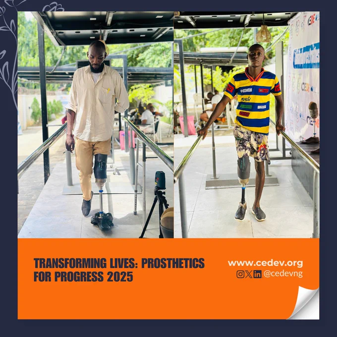In Nigeria, many people are living with one disability or another. Most of them with a limb loss cannot afford a prosthetic limb. When that happens, life can feel like it has stopped, school pauses, jobs are lost, and confidence fades.

Through the Transforming Lives: Prosthetics for Progress, some are walking again. Some of the youth are going back to school. Some are back to work, and some of the business traders have resumed their trade. This is a part of our mission.

Swipe down to witness more lives transformed.

#CEDE #CEDEV #TransformingLives #ProstheticsForProgress #ChenEducationandDevelopment