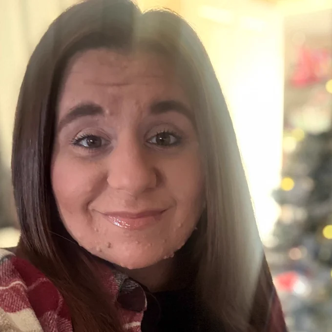 Ashleigh is a South-asian woman with small tumours mostly on her chin. She stands in front of a Christmas tree and smiles at the camera.