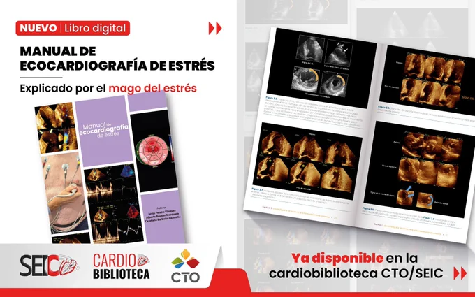 Manual de Ecocardiografía de Estrés disponible en la Cardio Biblioteca de la SEIC