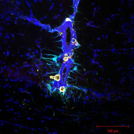 Cryptocococci immunofluorescent Image by Adrian Requejo