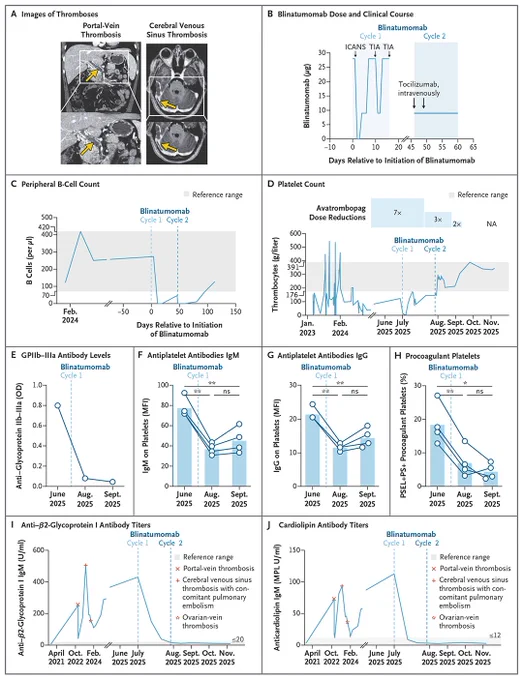 A figure showing treatment with CD19-directed bispecific T-cell engager in resistant immune thrombocytopenia and antiphospholipid syndrome.
