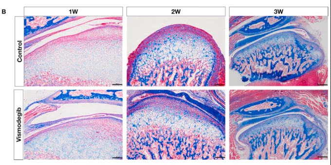 Fig. 3. Histological analysis of TMJ in fetal mice from the experimental and control groups at postnatal weeks 1–3 using H&E and Masson's trichrome staining. B: Masson's trichrome staining; red dashed lines indicate the boundary between the chondrocyte layer and prechondrocyte layer, while yellow dashed lines indicate the boundary between the chondrocyte layer and hypertrophic chondrocyte layer. (N = 6. Scale bar = 100 μm)