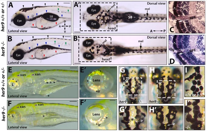 Fig. 3. Her9 mutants display pigmentation defects. A-B′) Lateral (A-B) and dorsal (A′-B′) views of melanophore patterning in WT/heterozygous and her9 mutant larvae at 6 dpf. Black arrowheads, dorsal stripe; green arrowheads, lateral stripe; blue arrowheads, ventral stripe; red arrowheads, yolk stripe; SB, swim bladder. C-D) H&E staining of WT/heterozygous and her9 mutant retina at 7 dpf; the retinal pigmented epithelium (RPE) is indicated with a white arrow. E-F′) Xanothophore (xan) and iridophore (ir) patterning in WT/heterozygous and her9 mutant larvae. Her9 mutants have reduced abundance of iridiphores (asterisks) and greater spread of xanthophores (yellow) than WT or heterozygous siblings. G-I′) Dorsal view of iridiphores and melanophores on the heads of WT/heterozygous and her9 mutant larvae.