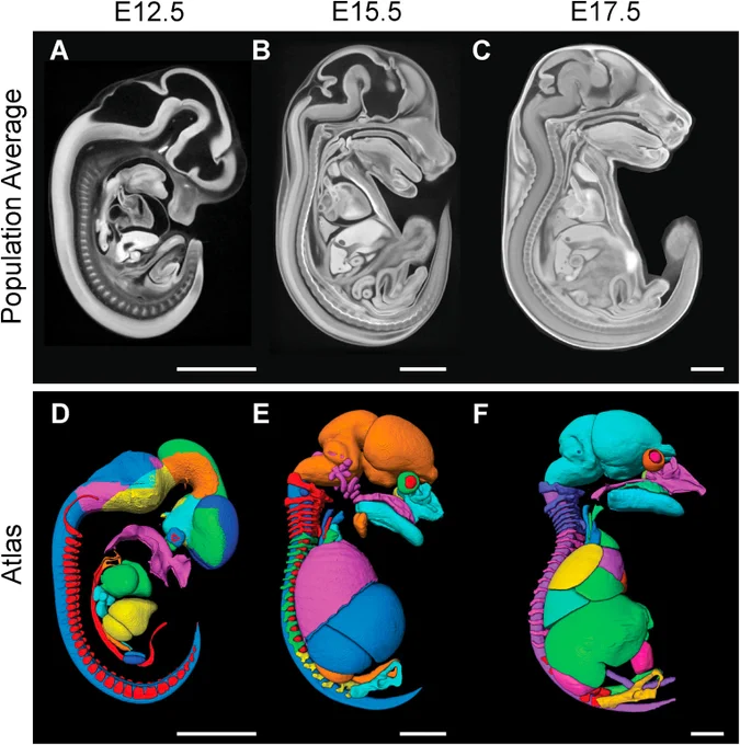 Fig. 1. Creation of three new embryonic mouse PTA-based population averages and matching atlases. (A) Sagittal view of E12.5 population average created from 11 wild type embryos at a voxel size of 7 μm3, (B) E15.5 population average created from 32 wild type embryos at voxel size of 14 μm3, (C) E17.5 population average created from 22 wild type embryos at voxel size of 14 μm3 which was resized to 28 μm3. (D–F) Corresponding atlases at (D) E12.5 with 43 labels, at (E) E15.5 with 47 labels and at (F) E17.5 with 46 labels. Only a subset of labels are shown for illustrative purposes. Scale bar = 2 mm.