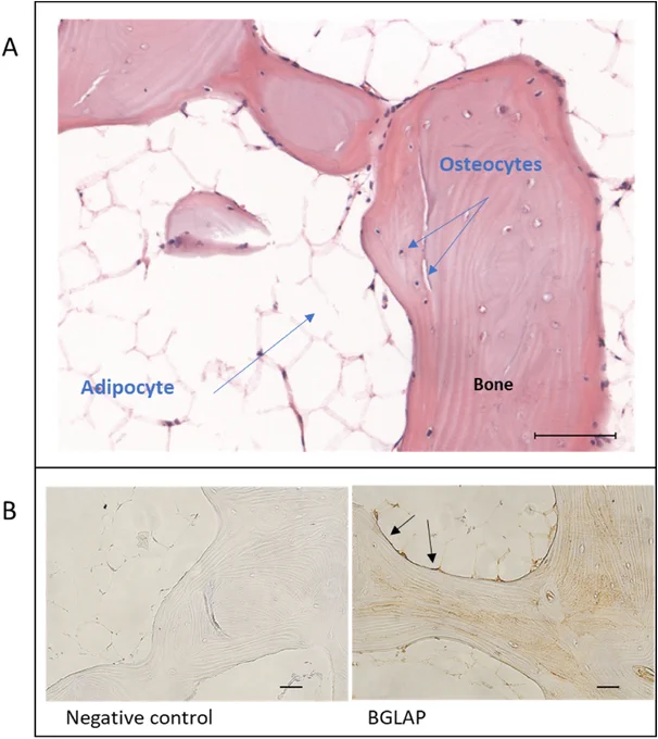 Fig. 2. Characterization of bone fragments A. Representative H&E stained section of bone fragment showing abundant adipocytes in the bone marrow next to mineralized bone with osteocytes. Bar = 100 μm. B. Representative histological slides of BGLAP (Bone Gamma-Carboxyglutamate Protein) immunoreactivity in human bone samples. The black arrows point out the presence of lining osteoblasts expressing BGLAP. Bar = 50 μm.