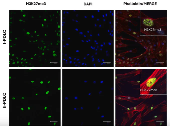 Fig. 1. Basal characterization of the epigenetic mark H3K27me3, the epigenetic enzymes associated with H3K27me3 levels and key osteogenic genes. 