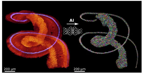 A cochlea imaged in light-sheet microscopy (right) with staining for spiral ganglion neurons (red) and inner hair cells (blue). You will develop AI-based methods to analyze these structures, for example via segmentation of the individual cells (right) that will support gene therapy development for hearing loss and a better overall understanding of the anatomy of hearing.