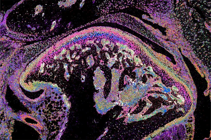 Spatial transcriptomics of the mouse temporomandibular joint (TMJ) using seqFISH, from the dataset "Spatial Transcriptomics of Mouse CFA-induced TMJ arthritis" https://doi.org/10.25550/8Q-3KAR)