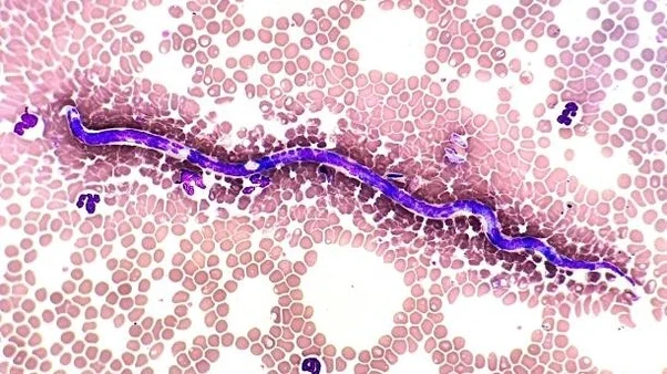 Why are tapeworms not digested in human intestines? Answer by Tyson Hanry, former doctor