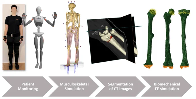Visualization of the workflow starting with the patient monitoring, then the inverse dynamic calculation of the joint forces, the generation of the 3D models, and the FE simulation with the applied boundary conditions.