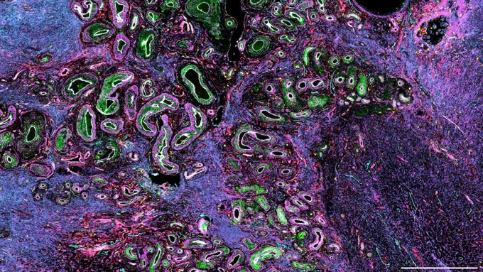 CODEX image of an ovary.

Stroma and ECM - green and blue; Endothelium - red, white, magenta, and cyan; Macrophages - yellow