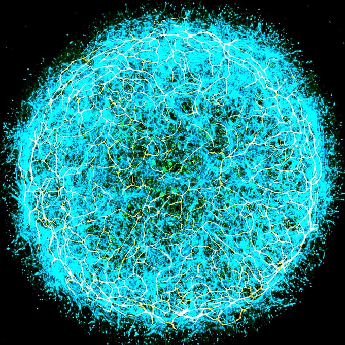 image of a miBrain - a research tool used to study the aging brain