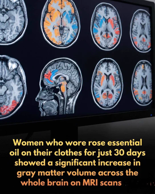 Research confirms smelling rose essential oil for just 30 days can physically expand your brain’s gray matter.

A groundbreaking study has discovered that the simple act of wearing rose essential oil can lead to visible structural changes in the human brain. Over a 30-day period, participants who wore the scent on their clothing showed a significant increase in gray matter volume across the entire brain, as confirmed by MRI scans. This transformation is driven by aromatic molecules traveling through the olfactory system directly to the limbic system—the brain’s emotional and memory hub. Researchers highlighted the posterior cingulate cortex (PCC) as a primary responder, suggesting that consistent scent exposure keeps this region active in processing memories and fostering neural growth.

Beyond structural expansion, this continuous stimulation activates vital neural pathways and encourages neuroplasticity, the brain's ability to reorganize itself. 