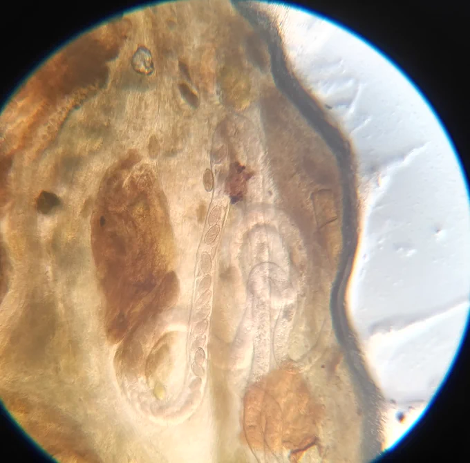 A microscopic view of Christian's poo sample, showing adult roundworm carrying and expelling eggs.