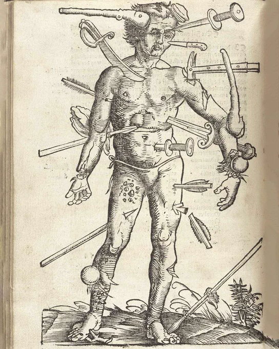 A drawing of a man in a posing pouch, with all sorts of weapons sticking out of him, including spears, clubs, swords and daggers. He's also got cuts and bullet wounds.