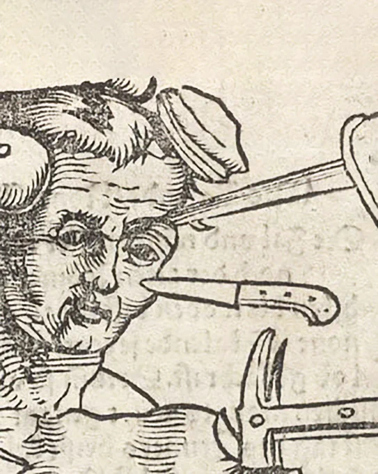 A closeup of wound man's head, with what looks like a pie on his left temple.