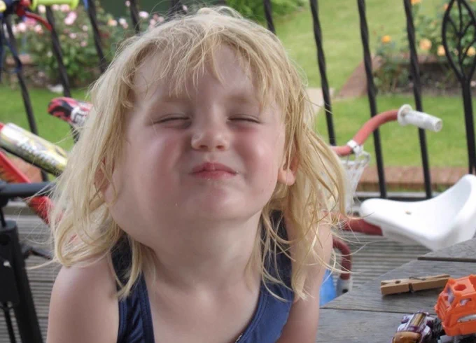 Abi as a child - blonde hair and fringe, on an outside balcony, eyes shut and a cheeky grin at the camera. Her lymphatic malformation is presented as a swelling on the side of her neck extending across her jawline.