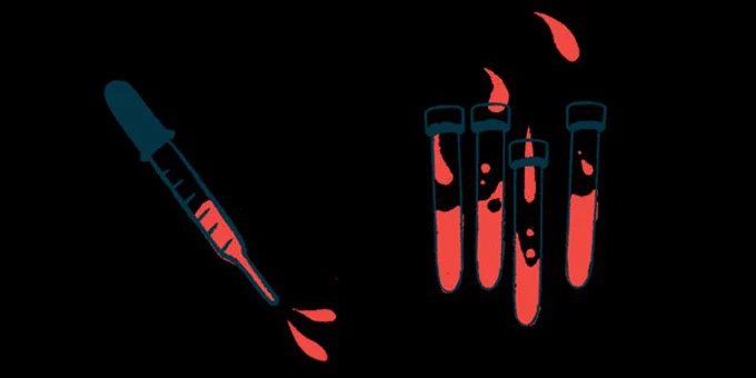 A squirting dropper is shown next to a collection of blood-filled vials.