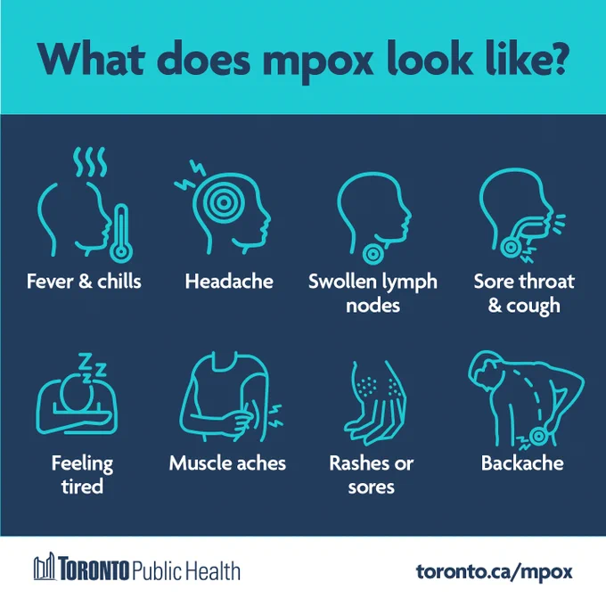 Infographic in navy, teal & white colours. Title is ‘What does mpox look like?’. Underneath are icons showing symptoms with text; fever & chills; headache; swollen lymph nodes; sore throat & cough; feeling tired; muscle aches; rashes or sores; backache. The Toronto Public Health logo & link to toron